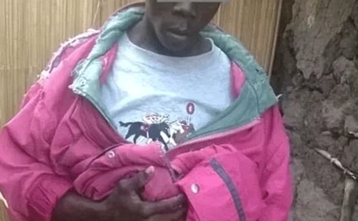 Acest kenian are un penis de zece ori mai mare decât al unui bărbat obișnuitFoto Daily Mail