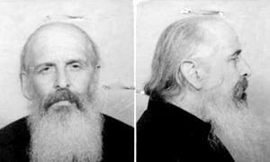 Un caz de parazitare jpeg