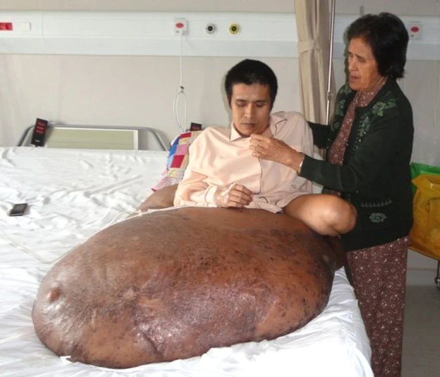 
    Bărbatul nu se poate mişca aproape deloc  