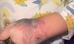 copil spital valcea jpg