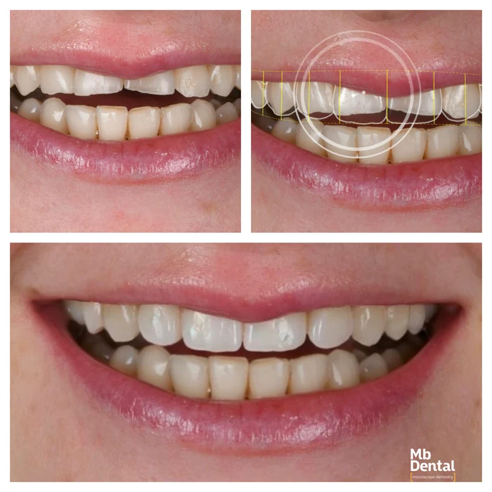 colaj caz MB Dental jpg