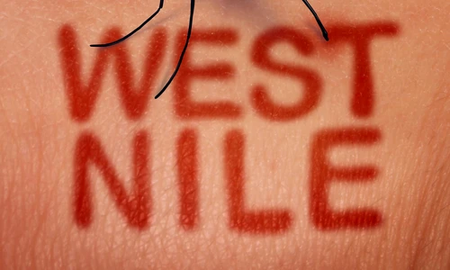 1 west nile jpg jpeg