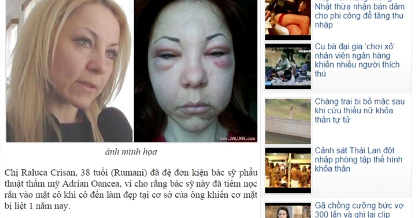 Cazul femeii de 38 de ani prezentat în presa din Vietnam