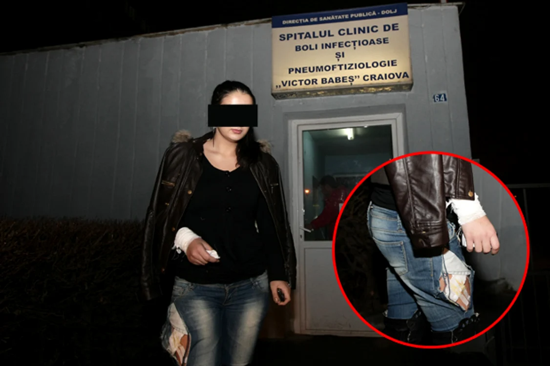 Tânăra a ajuns la spital cu răni la mână şi piciorul drept