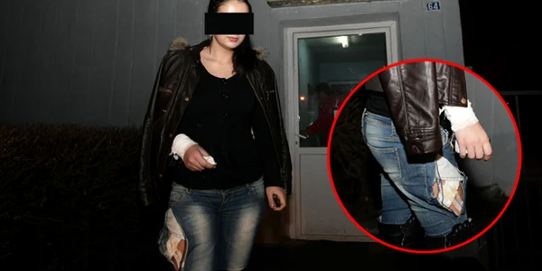 Tânăra a ajuns la spital cu răni la mână şi piciorul drept