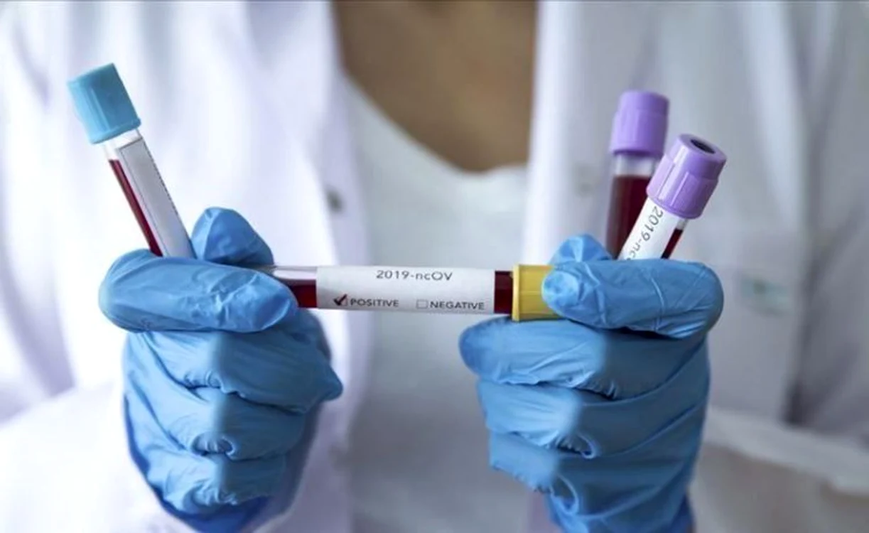 
    Un şofer de TIR din Timişoara a fost testat pentru coronavirus după ce s-a întros dintr-o cursă din Italia   