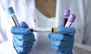 coronavirus timisoara jpeg