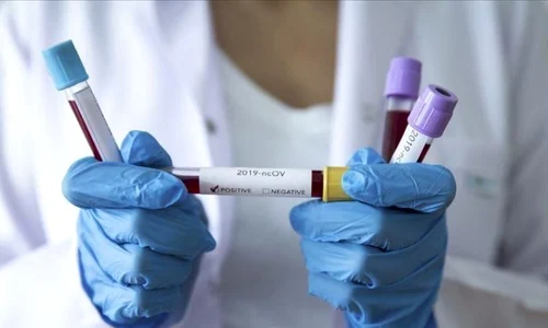 coronavirus timisoara jpeg