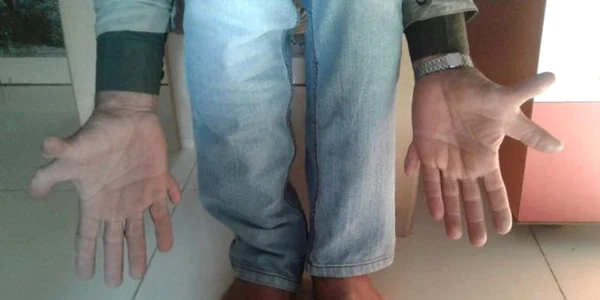 foto