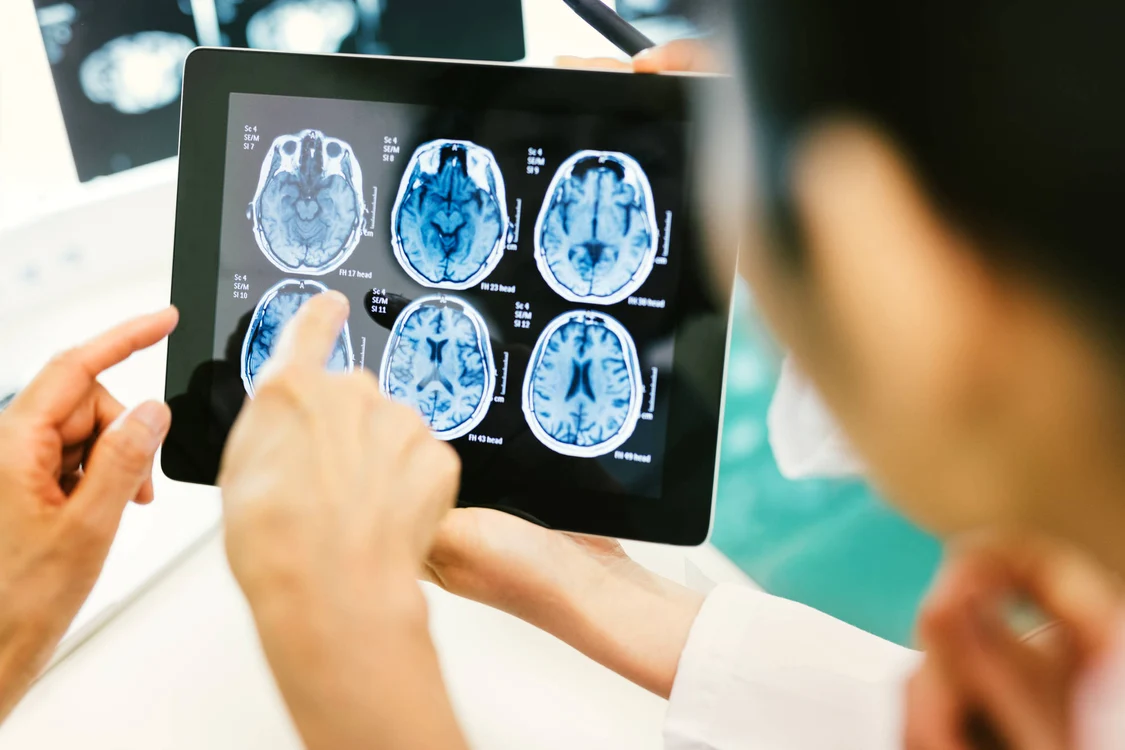 Implantul cerebral îi va permite pacientului să-și miște brațele din nou