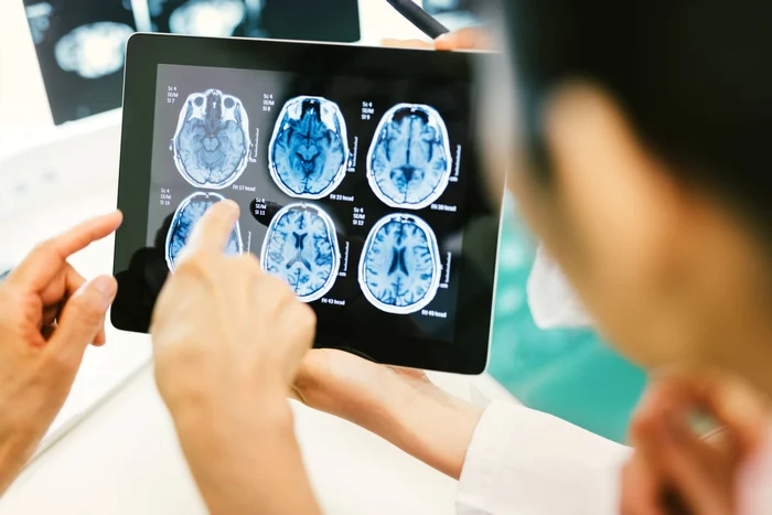 Implantul cerebral îi va permite pacientului să-și miște brațele din nou