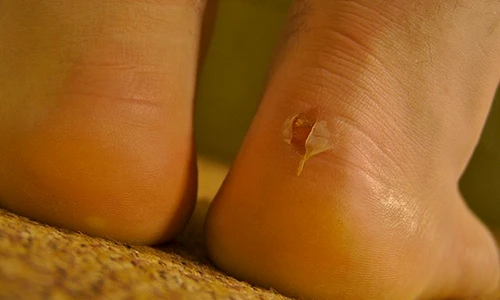 1 70487 original jpg jpeg