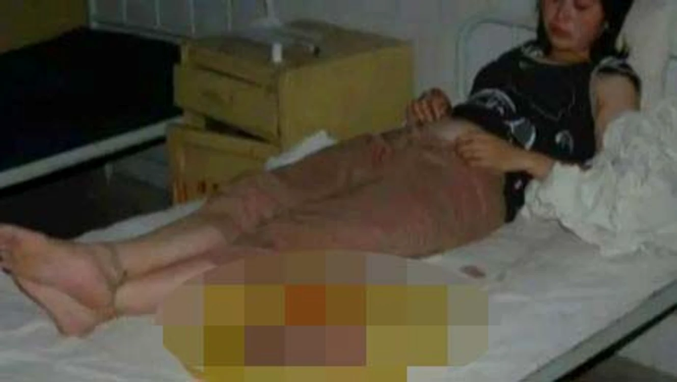 
    Femeia a năcut un copil mort  