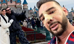 Când își dorește Dorian Popa să devină tătic  De ce era necesară acum operația la nas 