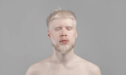 piele palida_shutterstock 2151466531 jpg