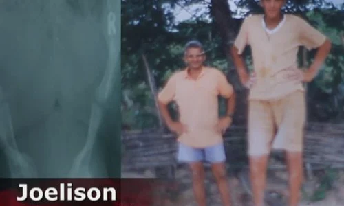 Joelison, la vârsta de 17 ani jpeg