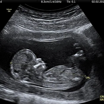 2 justin bieber sarcina jpg jpeg