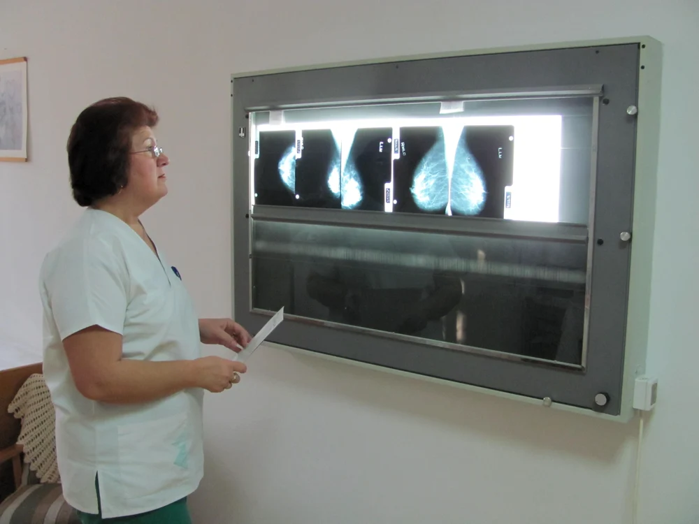 Botoşani: Mamograf la Maternitatea 