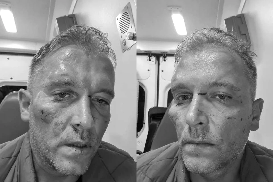 Bărbatul agresat s-a fotografiat şi a făcut imaginile publice