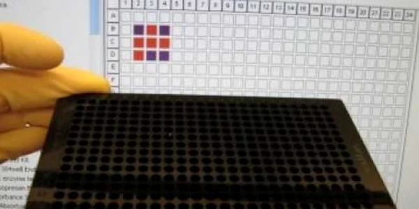 Computer cu ADN