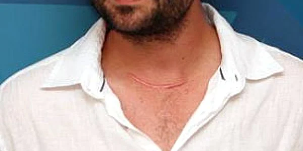 Tudor Ganea