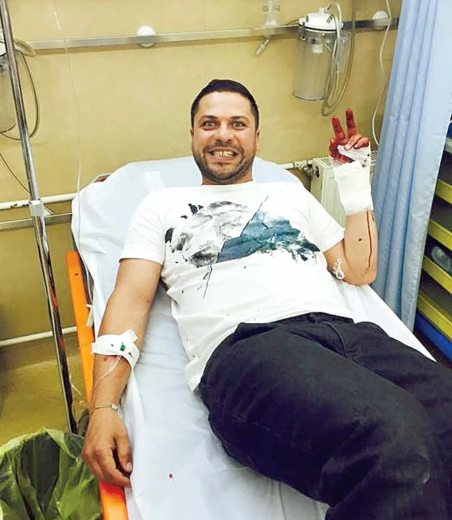 Augustin Viziru –  “Ferma vedetelor” ! trei tendoane  secţionate cu toporul  ! a riscat pentru  premiul de 50.000 de euro