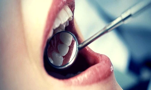 1 76391 original jpg jpeg