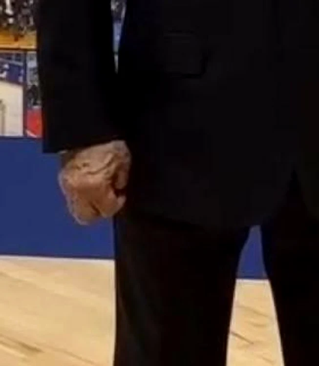 Vladimir Putin are mâna dreaptă umflată și vizibil rigidă FOTO: X/ @Gerashchenko_en