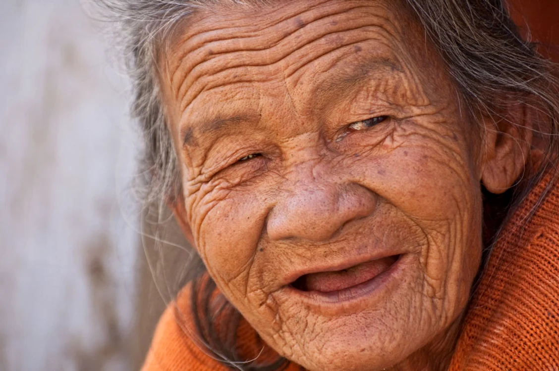 
     Alzheimer este o boală degenerativă care duce la deces   
