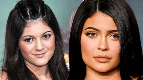 6 kylie jenner operatii estetice jpg jpeg