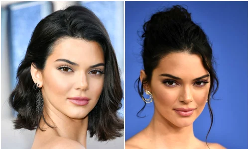 kendall jenner operatii jpeg