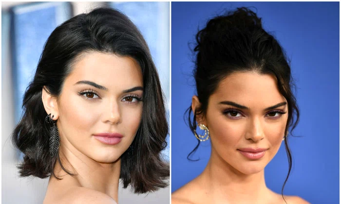 kendall jenner operatii jpeg