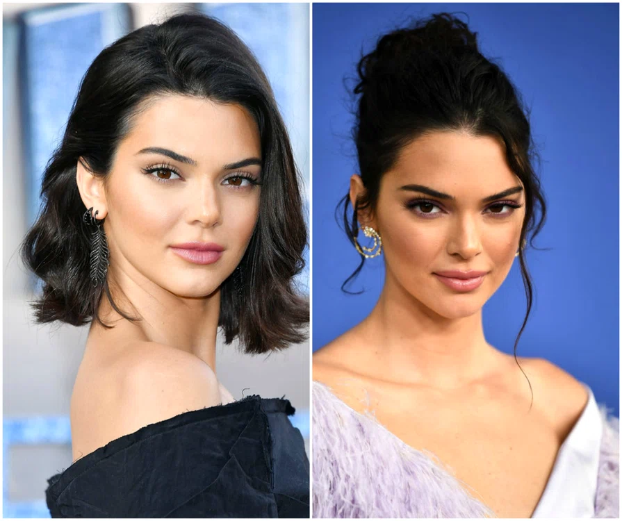 kendall jenner operatii jpeg
