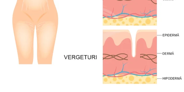 Vergeturi