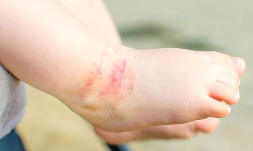 1 85433 original jpg jpeg