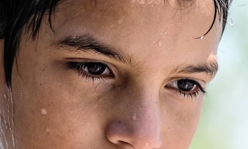 1 transpiratia excesiva la copii jpg jpeg