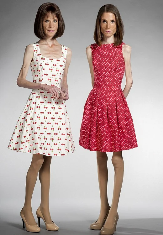 La 36 de ani, sunt măcinate de boli şi abia se mai ţin pe picioare