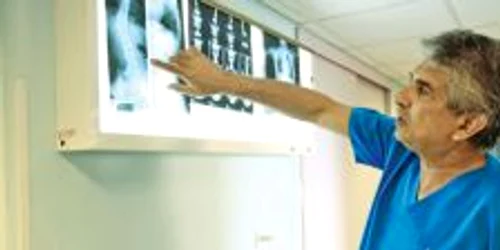 Gheorghe Burnei este şeful Clinicii de ortopedie pediatrică a Spitalului „Marie Curie”.