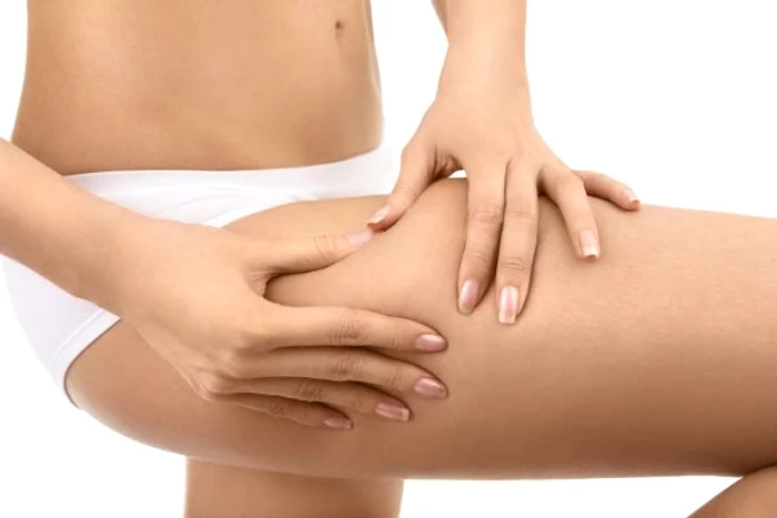 Poţi scăpa de celulită prin sport, o dietă sănătoasă şi tratamente naturiste