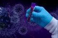 coronavirus bilant 9 ianuarie jpg