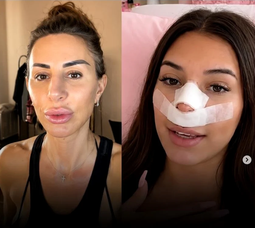 Motivul halucinant pentru care şi-a operat nasul. FOTO. Instagram