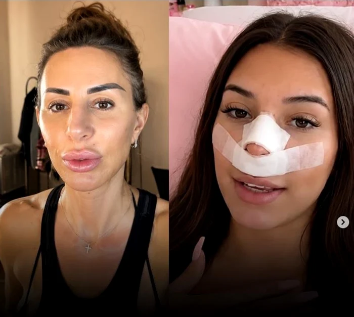 Motivul halucinant pentru care şi-a operat nasul. FOTO. Instagram