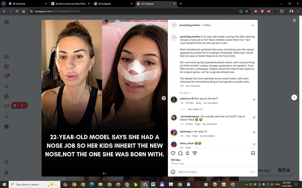 Influencerița care și-a făcut rinoplastie pentru ca viitorii săi copii „să nu îi moștenească nasul”. Ideea a primit replici pe măsură: „La o operație pe creier te-ai gândit?”