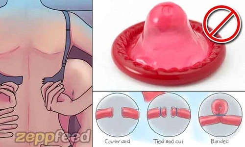 1 cinci metode prin care sa eviti sarcina fara sa folosesti prezervativul gdid jpg jpeg