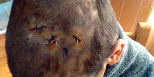 Un copil aflat în grija statului a ajuns la spital după ce a fost bătut de un alt coleg 