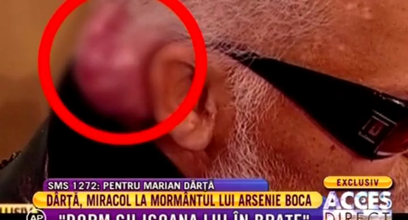 Ca prin minune, tumoarea lui Marian Darta s-a micşorat. A ajuns cât o nucă