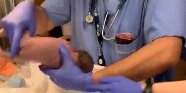 bebelus cazut din mainile medicului
