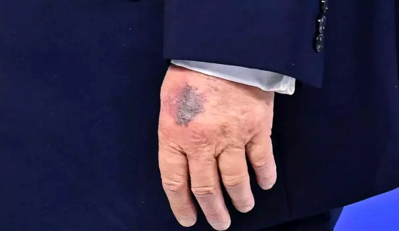 trump vanataie jpg