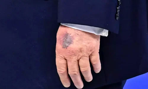 trump vanataie jpg
