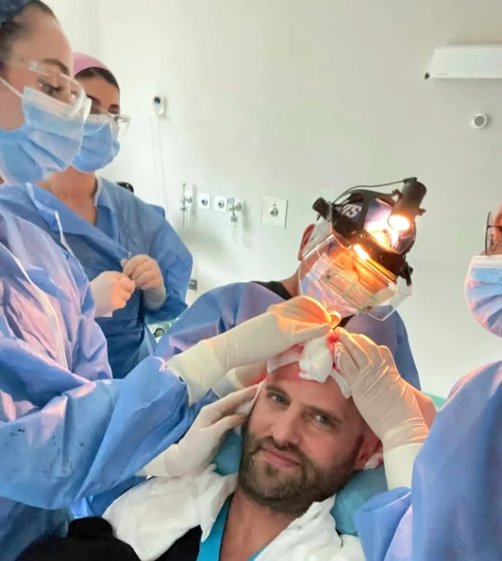 Sorin Brotnei a făcut cel de-al doilea transplant de păr foto: Instagram 